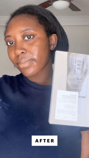 BlayTettey after applying the Dr. Althea 345 Relief Cream Mask