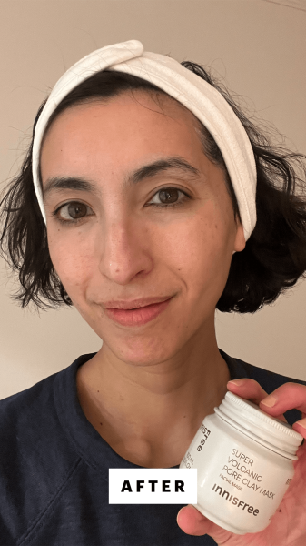 Pai after using the Innisfree Super Volcanic Pore Clay Mask